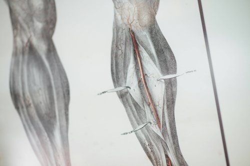 Suture de Plaies Aiguës Urgentes en Essonne